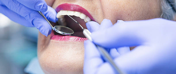 Best Emergency Dentist for Lost Fillings or Crowns in Pike Road, AL